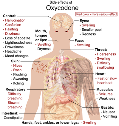 800px-Side_effects_of_OxycodoneHäggström, Mikael (2014).png